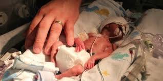 Some problems may be apparent at birth, while others may not develop until later. An Open Letter To Preemie Parents From A Micro Preemie Mom Huffpost Life