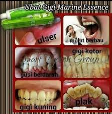 Maybe you would like to learn more about one of these? Ubat Gigi Garam Buluh Kuantan Posts Facebook