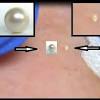 Sanitize a sharp needle (the finer point the better) and tweezers or comedone extractor. Https Encrypted Tbn0 Gstatic Com Images Q Tbn And9gct7jsnjob2cinhcfmnulxuwvrtavybk6ffy Qsnvasmfhmskqbh Usqp Cau