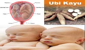 Memiliki anak kembar tentu tak sekedar menikmati enaknya saja. Wanie Wanieun Cantik Cara Mudah Mendapatkan Anak Kembar Perempuan Trik Ini Terbilang Kuno Tapi Hasilnya Jempolan