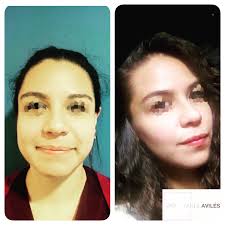 Dra. Tania Avilés Díaz (@dra.avilescirugiaplastica) · Chetumal