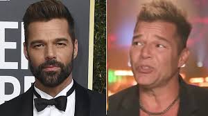 Ricky Martin salió a explicar qué fue lo que pasó con su rostro