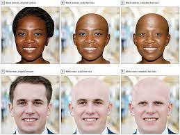 Hair loss is a common clinical complaint that is a manifestation of a wide variety of disorders. Society Stigmatises Hair Loss And Alopecia Study Finds Daily Mail Online