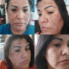 Tara Hinkle (@celestial_esthetics_skincare) · Lakewood, CO