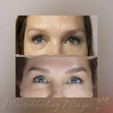 Classic microblading This client arrived with 5 year old microblading  (using iron oxide pigments) from somewhere in Chicago. She hated the orange  color that remains in her skin. I improved upon the