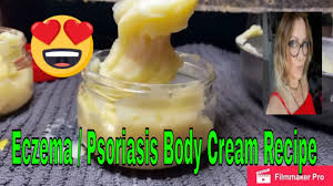 I'm pinning this for my friend! Eczema And Psoriasis Body Butter Recipe For Skin 2021 Bodybutter Psoriasis Eczema Scar Youtube