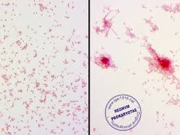 Salmonella typhimurium (salmonella enterica subsp. Abis Encyclopedia