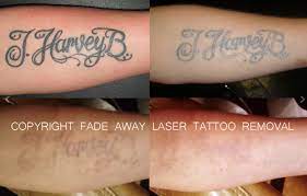 The expiration date of the provisional license does not change. Benchmark Tattoo Fade Away Laser Tattoo Removal 1831 E 8th St G102 Duluth Mn 55812