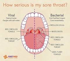 Sore Throat Viral Vs Bacterial Health Resources Sick Remedies Good To Know