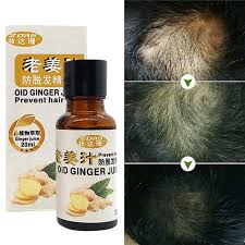 Carrot juice benefits for the health of hair. Ginger Juice Hair Loss Products Natural With No Side Effects Grow Hair Faster Regrowth Hair Growth Oil Hair Scalp Treatments 4 Hair Loss Hair Loss Productshair Growth Aliexpress