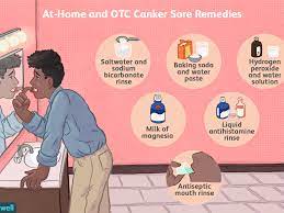 How To Get Rid Of Canker Sores: Salt, Baking Soda, & More