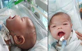 Bayi tular yang semakin sembuh daripada pembedahan ketumbuhan, adik ainul mardhiah ahmad safiuddin menunjukkan perkembangan yang positif apabila dilihat semakin sihat dan 'bersemangat'. Adik Ainul Mardhiah Sudah Sedar Sabah Post