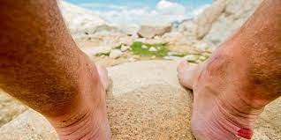 Make like rachel ray and grab your evoo. The Fastest Way To Heal A Blister Men S Health