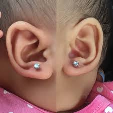 Uneven Ear Piercing May 2018 Babies Forums What To Expect