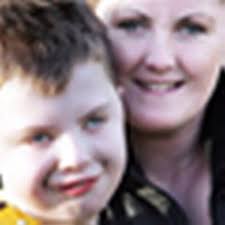 11-year-old born without ability to change expression