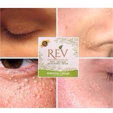 For more information and source,. Biji Kolestrol Removal Cream Shopee Malaysia