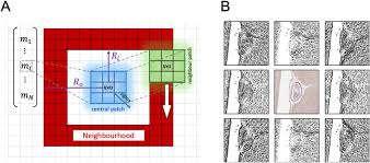 Tensor Image Registration Library Automated Non Linear Registration Of Sparsely Sampled Histological Specimens To Post Mortem Mri Of The Whole Human Brain Biorxiv