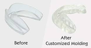 You need enough boiling water so that the entire mouthguard is immersed for between 30 to 60 seconds. How To Mold A Perfect Mouthguard Step By Step Guide With Video Explanation 2021