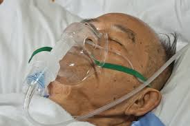 Oxygen cannulas or nasal cannulas are used to supply supplementary oxygen to the patient. Oxygen Administration From New To Icu