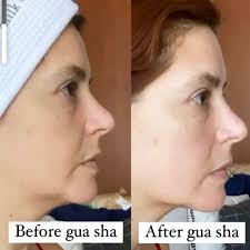 RESULTS ✨ Can you tell a difference? Facial gua sha with the  @wildling_beauty Empress Collection • The photo