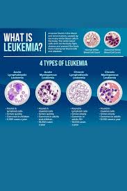 Image result for Leukemia