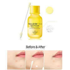 Bring color in this big interior design trend with beautiful, natural orchids. So Natural Yellow Cica Spot Powder 17ml Buy From 27 On Joom E Commerce Platform