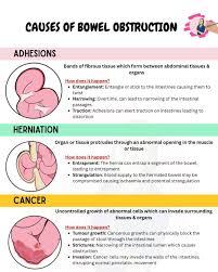 Image result for Intestinal Obstruction