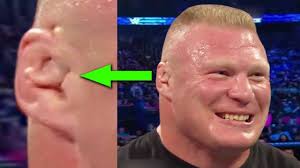 Why shouldn't the ufc be afforded the same power when they're actually paying the fighters? Wrestling News Now What S Wrong With Brock Lesnar S Ear 10 Weirdest Things On Wwe Superstars Facebook