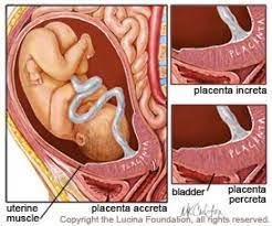 Pin On Sonography