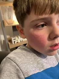 What could this be, an allergic reaction?