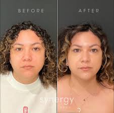 Laura Cady BSN, RN, CANS