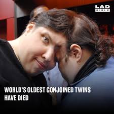 The twins defied medical predictions their entire life despite being fused  at the skull.