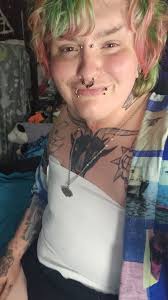 fif! i got top surgery