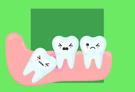 Dente Do Siso Veja Os Primeiros Sinais E Como Evitar Problemas
