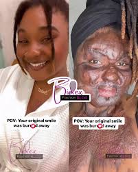 Learning to love myself again