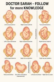 Image result for Compound Presentation