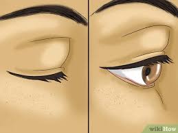 Contact lenses raise the risk of an eye infection and some infections can lead to vision loss or blindness if they're not treated. How To Take Out Contact Lenses Without Touching Your Eye 12 Steps