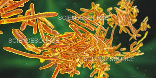 Image result for Erysipeloid