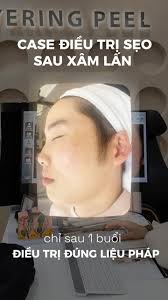 🧬 Đ𝐈𝐄̂̀𝐔 𝐓𝐑𝐈̣ 𝐒𝐄̣𝐎 𝐒𝐀𝐔 𝐌𝐔̣𝐍