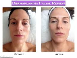 10 Dermaplaning ideas