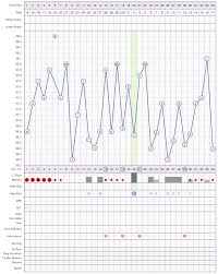 Anovulatory Cycles Ovagraph