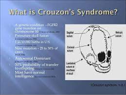 Crouzon S Syndrome Ad Typical Facies No Mental Retardation Also Called Craniofacial Dystocia As Small Mandibles Premature Syndrome Pediatrics