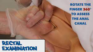 Rectal Examination (Pr) - Osce Guide - Youtube