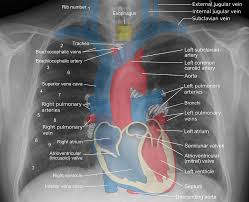 Deep Learning In Healthcare X Ray Imaging Part 2 Understanding X Ray Images In 2020 Medical Knowledge Radiology Student Medical Anatomy