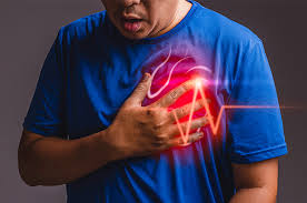 Impacto do enfarte agudo do miocárdio na qualidade de vida do índividuo. Infarto Agudo Do Miocardio Sintomas E Tratamentos Cepic