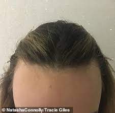 When my hair started to recede i looked around for hairstyles for receding hairlines and what i found wasn't actually that useful. Hairstyles For Receding Hairline Women Bpatello