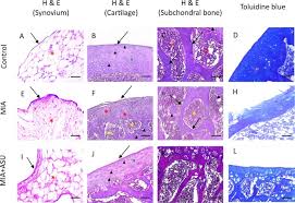 Order avosoya now, it's available in. Avocado Soybean Unsaponifiables Ameliorates Cartilage And Subchondral Bone Degeneration In Mono Iodoacetate Induced Knee Osteoarthritis In Rats Sciencedirect