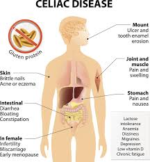 Celiac Disease And Celiac Disease Diet The Beginner S Guide Celiac Disease Diet Celiac Disease Celiac Disease Awareness