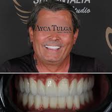 Assoc Prof Dr Ayça Tulga, DDS, PhD (@draycatulga) · Instagram 照片和视频