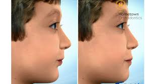 At What Age Does Your Face Stop Growing? - Quora